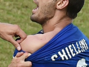 gty_giorgio_chiellini_bite_FIFA_2014_soccer_jc_140624_4x3_992